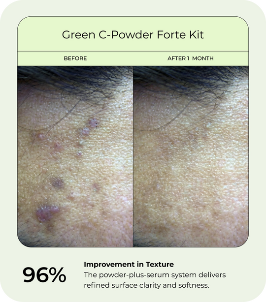 Before-and-after close-up of facial skin showing texture improvement after one month of using the DrJ SkinClinic Green C-Powder Kit, with visibly smoother, clearer skin in the after image and a highlighted 96% improvement in texture.