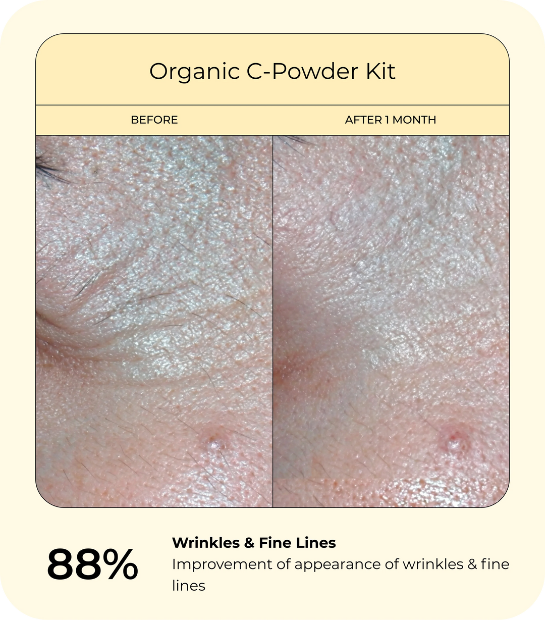 Before-and-after close-up skin comparison for the Organic C-Powder Kit showing wrinkles and fine lines before use and smoother-looking skin after one month, highlighting an 88% improvement in the appearance of wrinkles and fine lines.