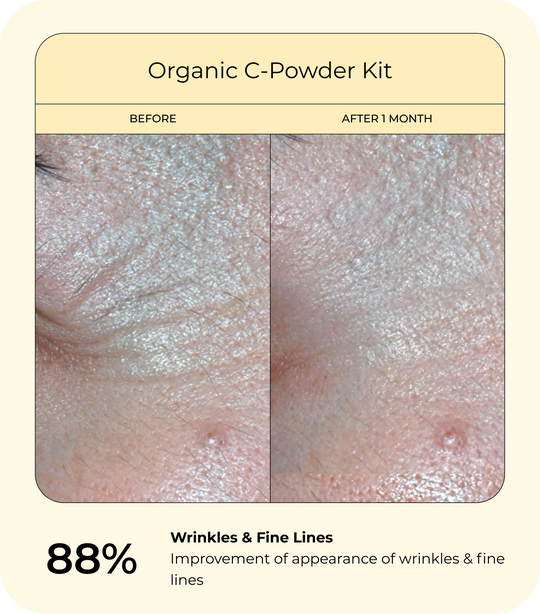 Before-and-after close-up skin comparison for the Organic C-Powder Kit showing wrinkles and fine lines before use and smoother-looking skin after one month, highlighting an 88% improvement in the appearance of wrinkles and fine lines.