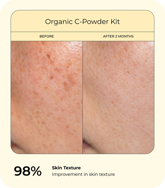 Before-and-after skin texture comparison for the Organic C-Powder Kit showing uneven texture before use and smoother, more refined-looking skin after two months, highlighting a 98% improvement in skin texture.