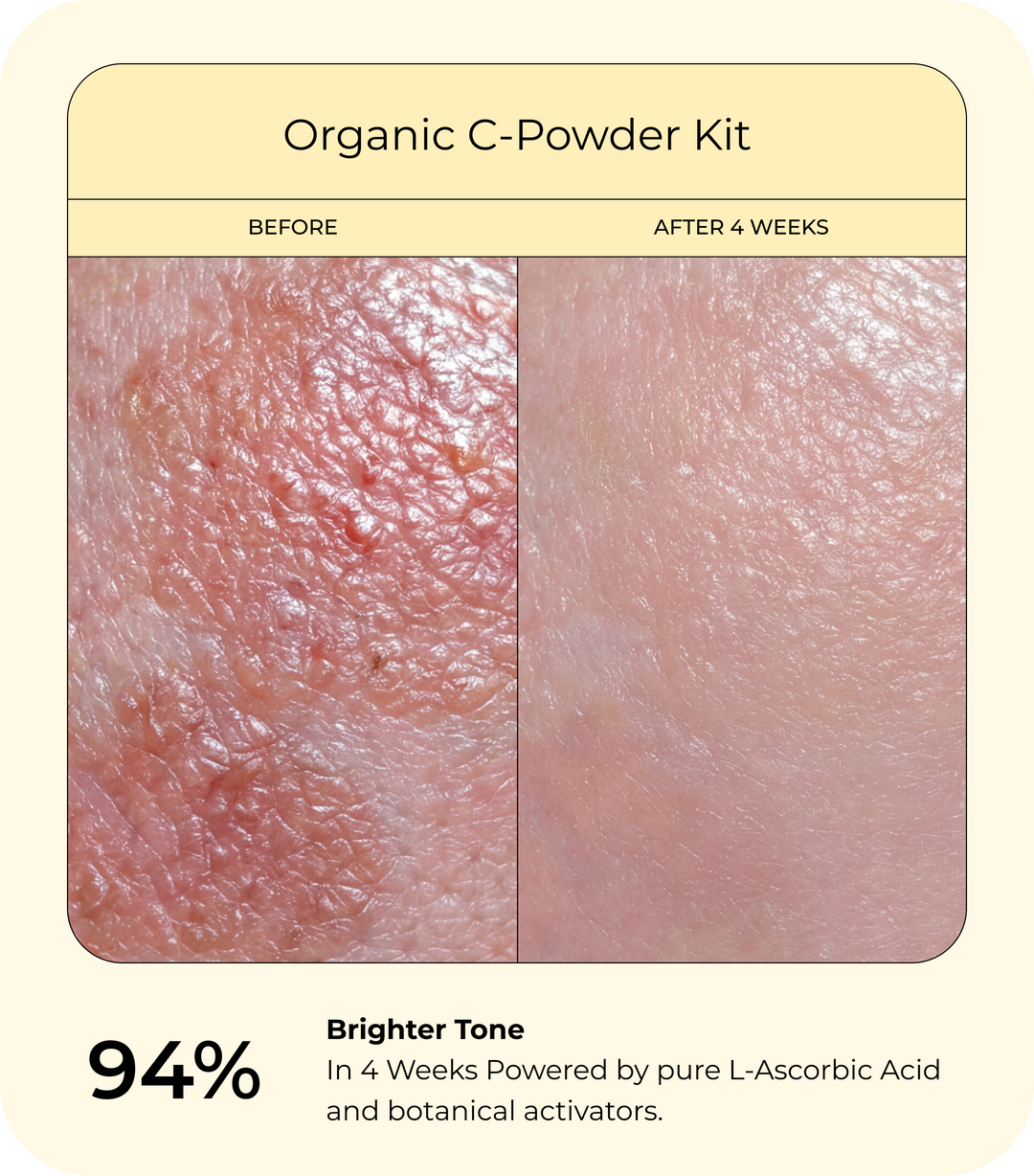 Before and after close-up of skin tone improvement after 4 weeks using DrJ SkinClinic Organic C-Powder Kit, showing brighter, more even-looking skin texture.